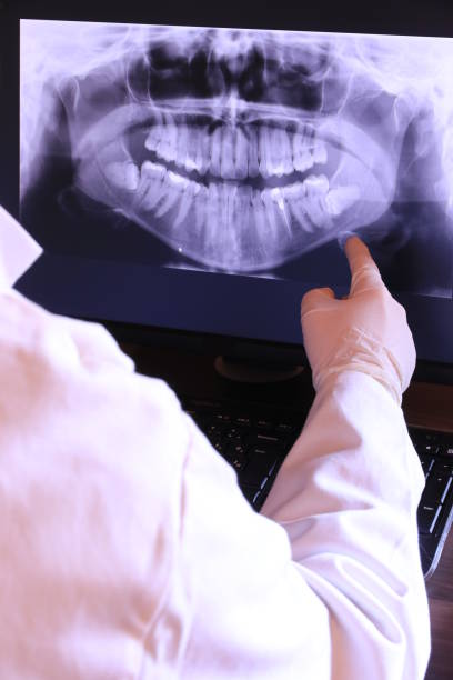 Best Emergency Dentist for Special Needs Patients in Soulsbyville, CA